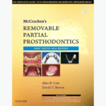 Removable Partial Prosthodontics 1st Edition