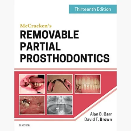 McCracken's Removable Partial Prosthodontics 13th Edition